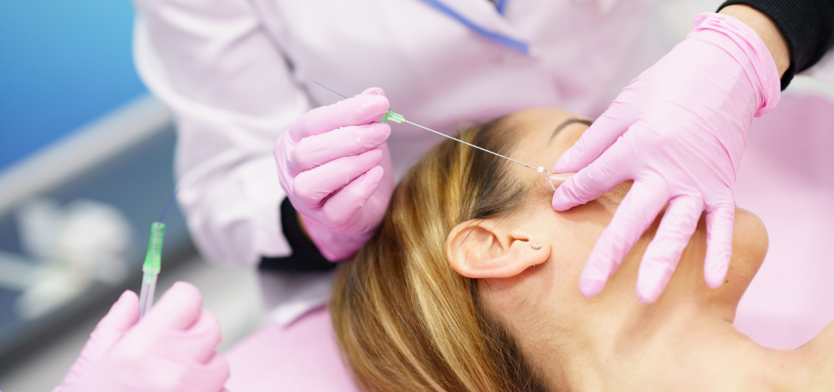 Fadenlifting mit PDO-Fäden zur effektiven Straffung der Gesichtskonturen und Hautverjüngung in der Praxis Juvanity Lampertheim