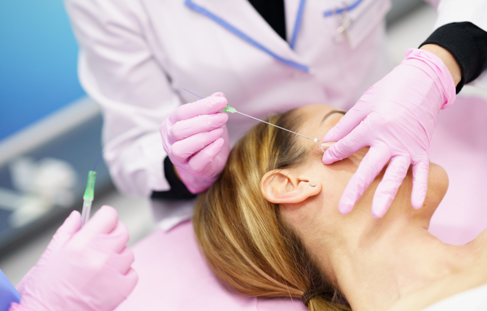 Fadenlifting mit PDO-Fäden zur effektiven Straffung der Gesichtskonturen und Hautverjüngung in der Praxis Juvanity Lampertheim