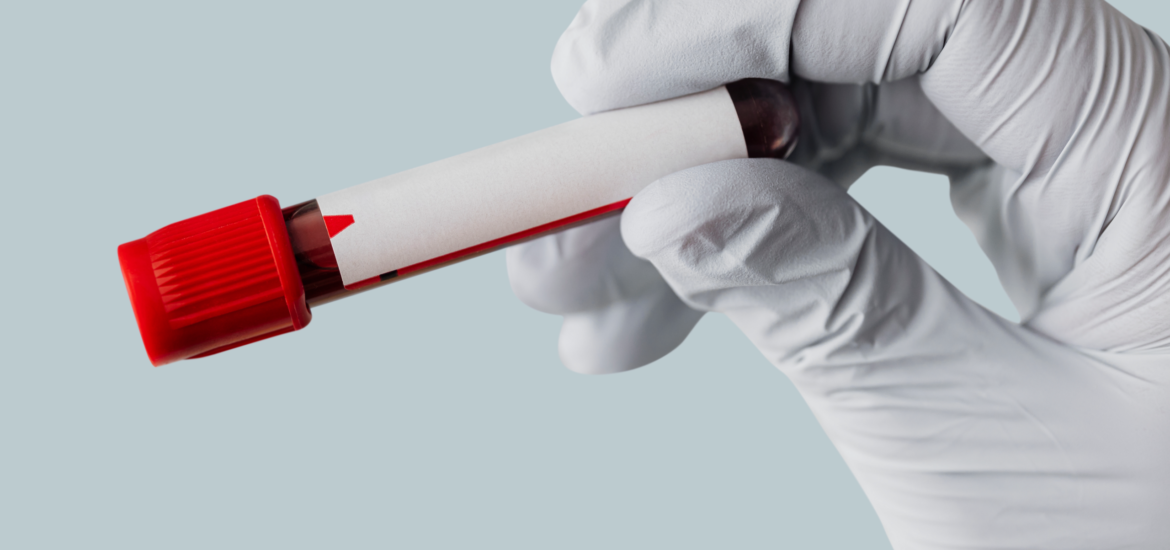 Sorgfältige Auswertung von Blutproben zur umfassenden Labordiagnostik und Infektionsanalyse in der Praxis Juvanity Lampertheim