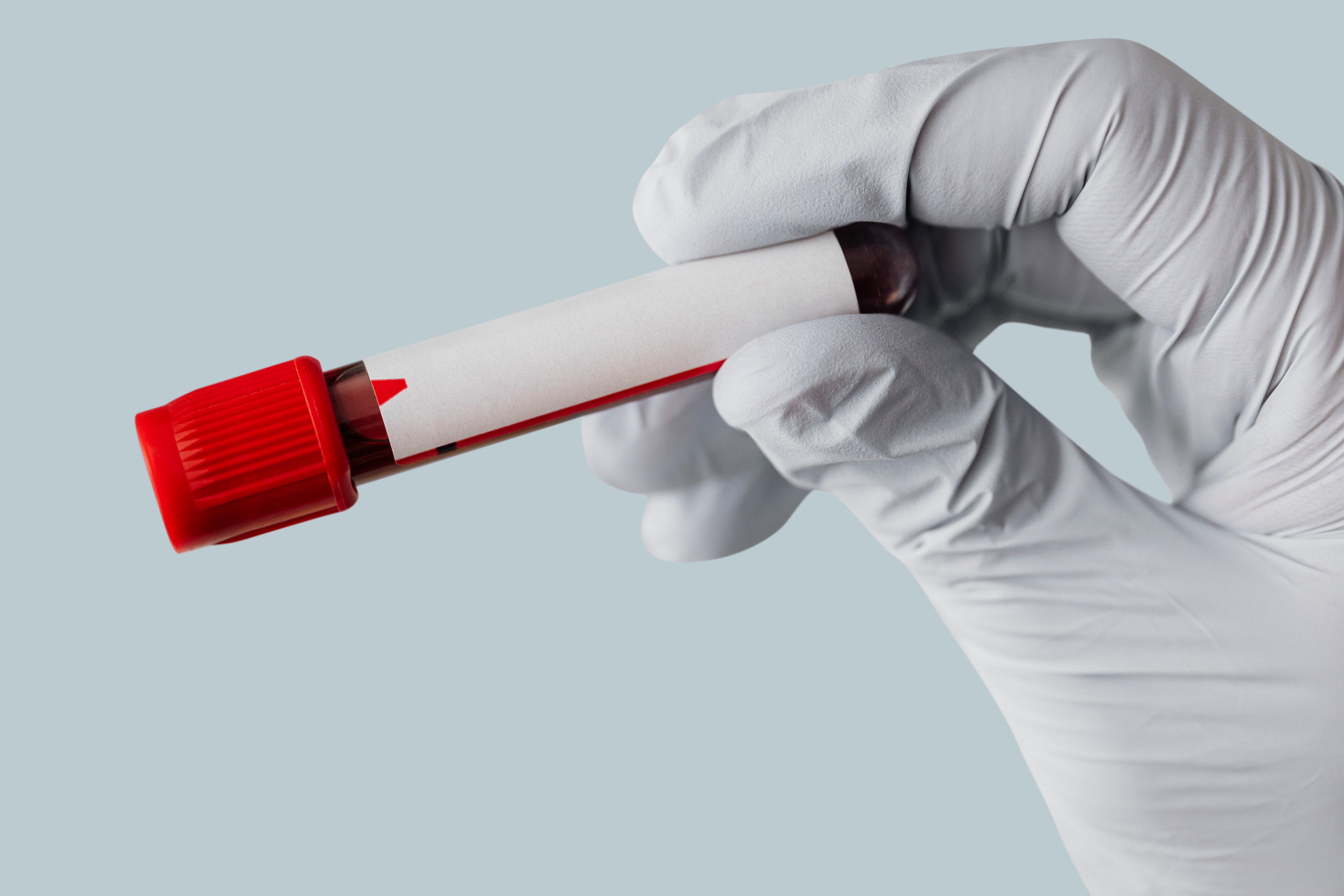 Sorgfältige Auswertung von Blutproben zur umfassenden Labordiagnostik und Infektionsanalyse in der Praxis Juvanity Lampertheim