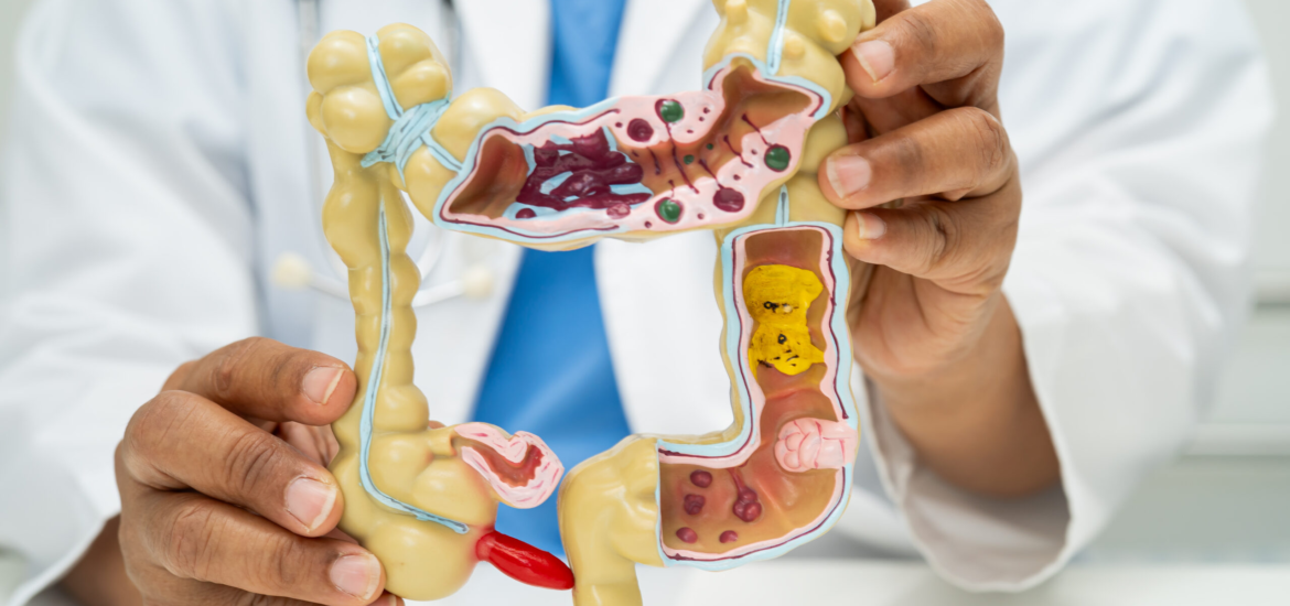 Anatomiemodell des menschlichen Verdauungssystems zur Patientenaufklärung und Diagnostik von Darmbeschwerden in der Praxis Juvanity Lampertheim