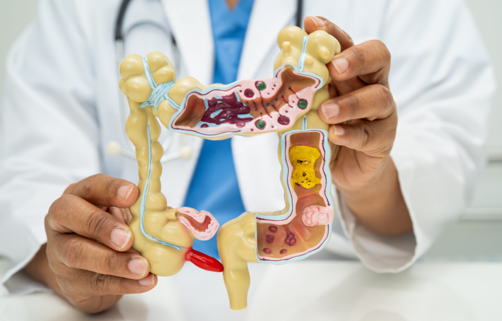 Anatomiemodell des menschlichen Verdauungssystems zur Patientenaufklärung und Diagnostik von Darmbeschwerden in der Praxis Juvanity Lampertheim