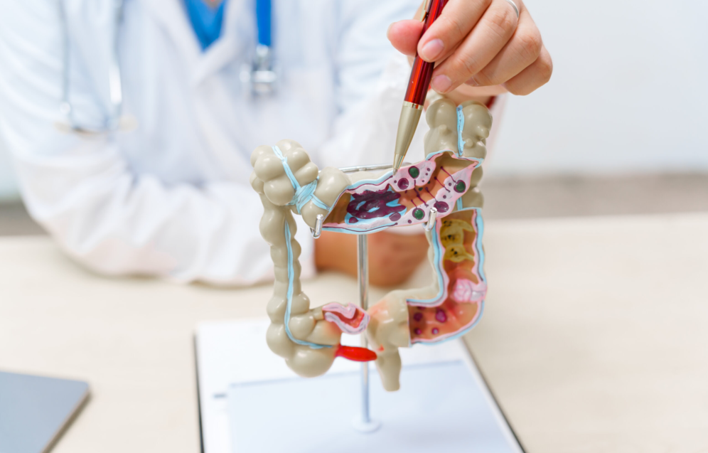 A doctor holds a human colon anatomy model, demonstrating the digestive system