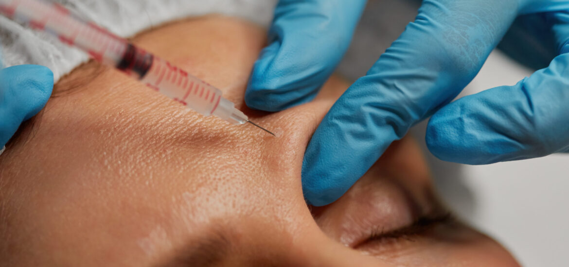 Hyaluron-Unterspritzung der Stirn als Anti-Aging-Behandlung in der Naturheilpraxis Juvanity