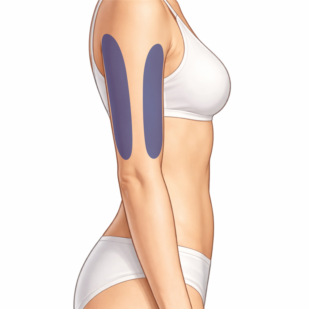 Fett weg Spritze Anwendung am Arm