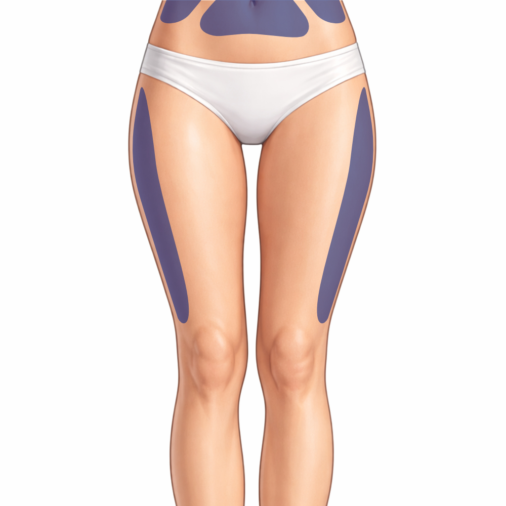 Fett weg Spritze Anwendung am Oberschenkel