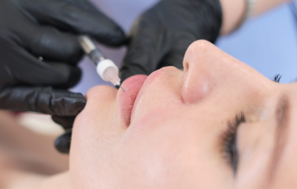 A cosmetologist carefully injects a client's lips. Enhancements come with both benefits and risks