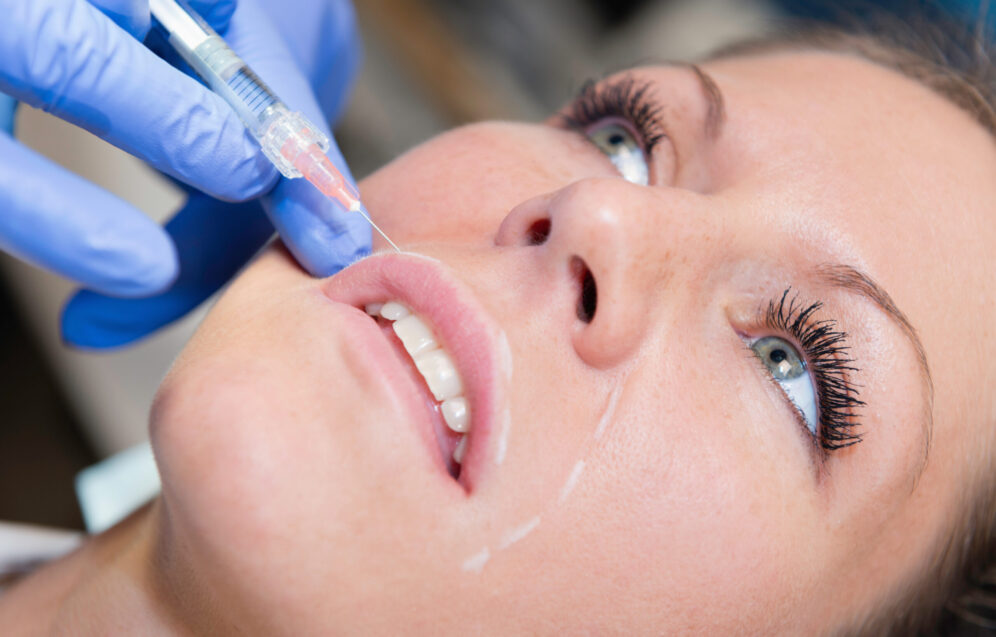 Beauty Treatment with hyaluronan