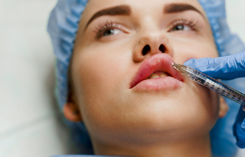 close-up-of-lip-filler-for-attractive-girl-surgeo-2026-02-08-05-38-15-utc