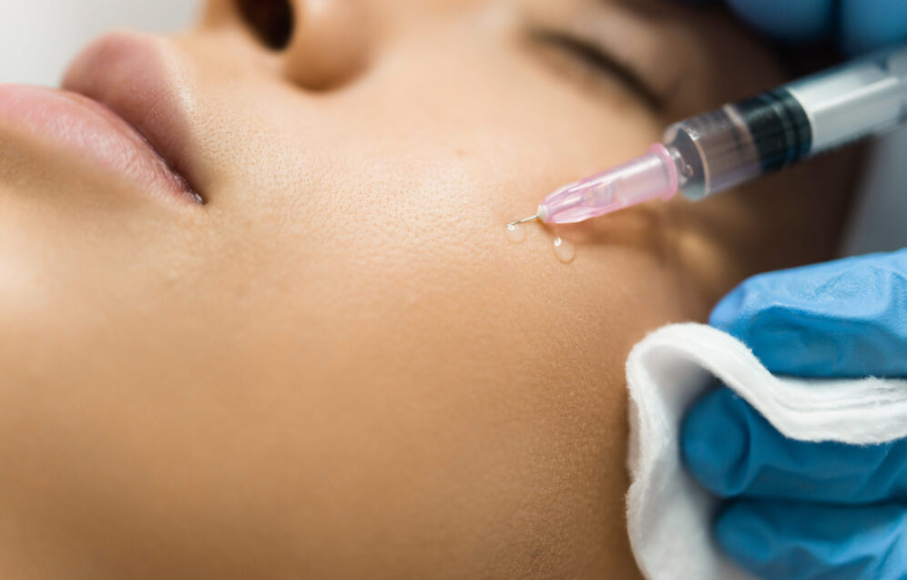 Close-up view of a beautician hands injecting hyaluronic acid into a patient's cheek