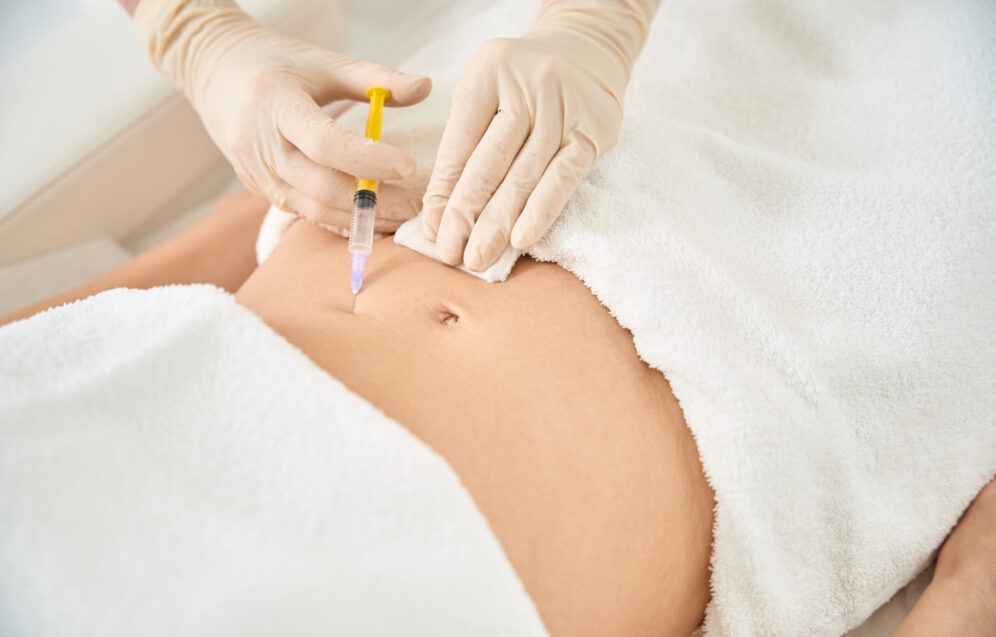 Close-up body plasmolifting procedure, qualified cosmetologist making injections of plasma into client belly to remove stretching marks and scar or sagged skin