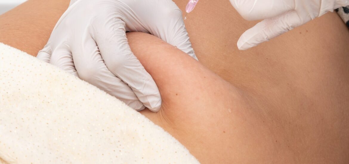 mesotherapy-of-the-abdominal-area-is-an-injection-2026-01-08-00-00-31-utc