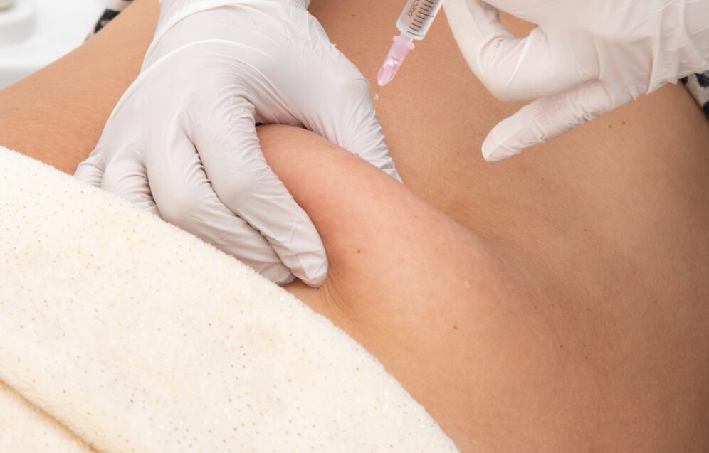 mesotherapy-of-the-abdominal-area-is-an-injection-2026-01-08-00-00-31-utc