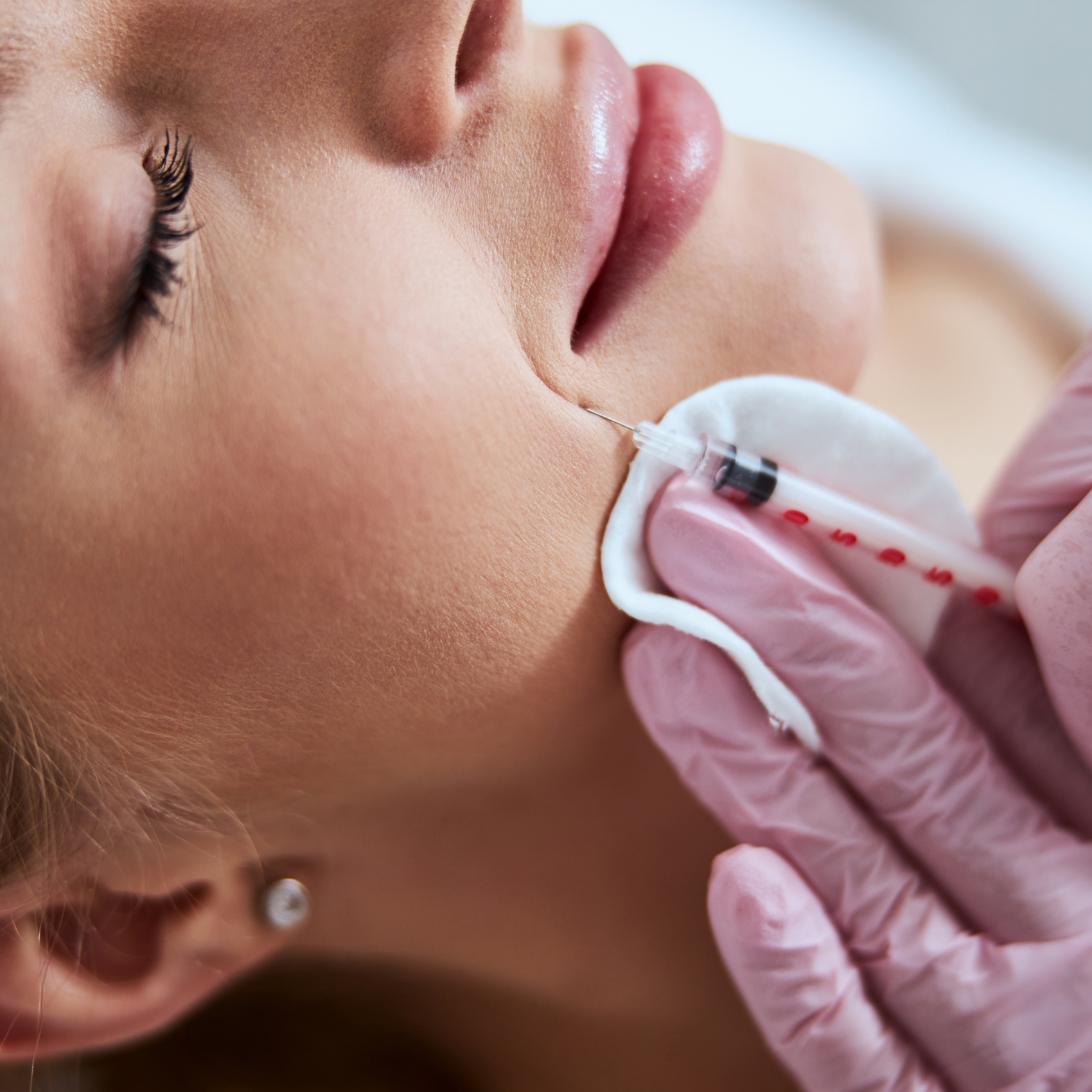 haarausfall Lampertheim