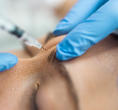 Hyaluron-Injektion an der Stirn und Augenbraue zur professionellen Faltenbehandlung in der Praxis Juvanity Lampertheim